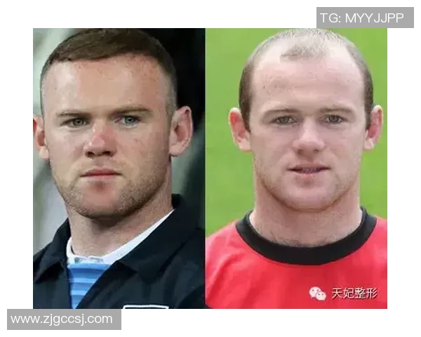 某足球明星因压力过大导致掉发引发粉丝热议与关心